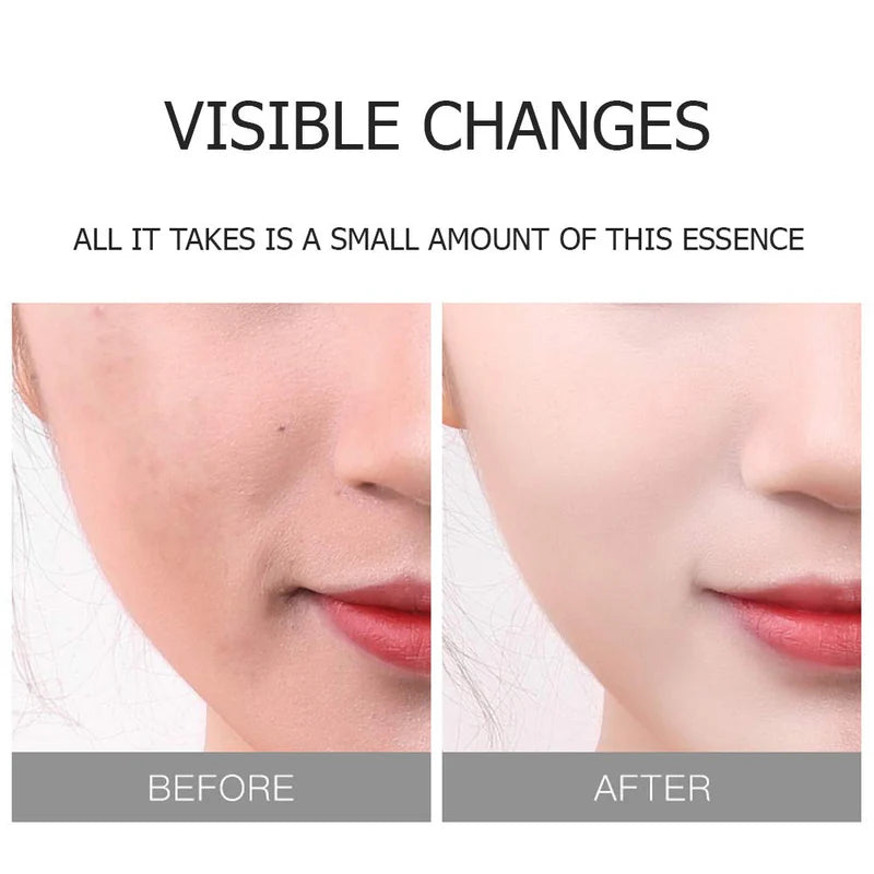 Sadoer Real Rose Facial Mask – Hydrating & Brightening Care (25 g)
